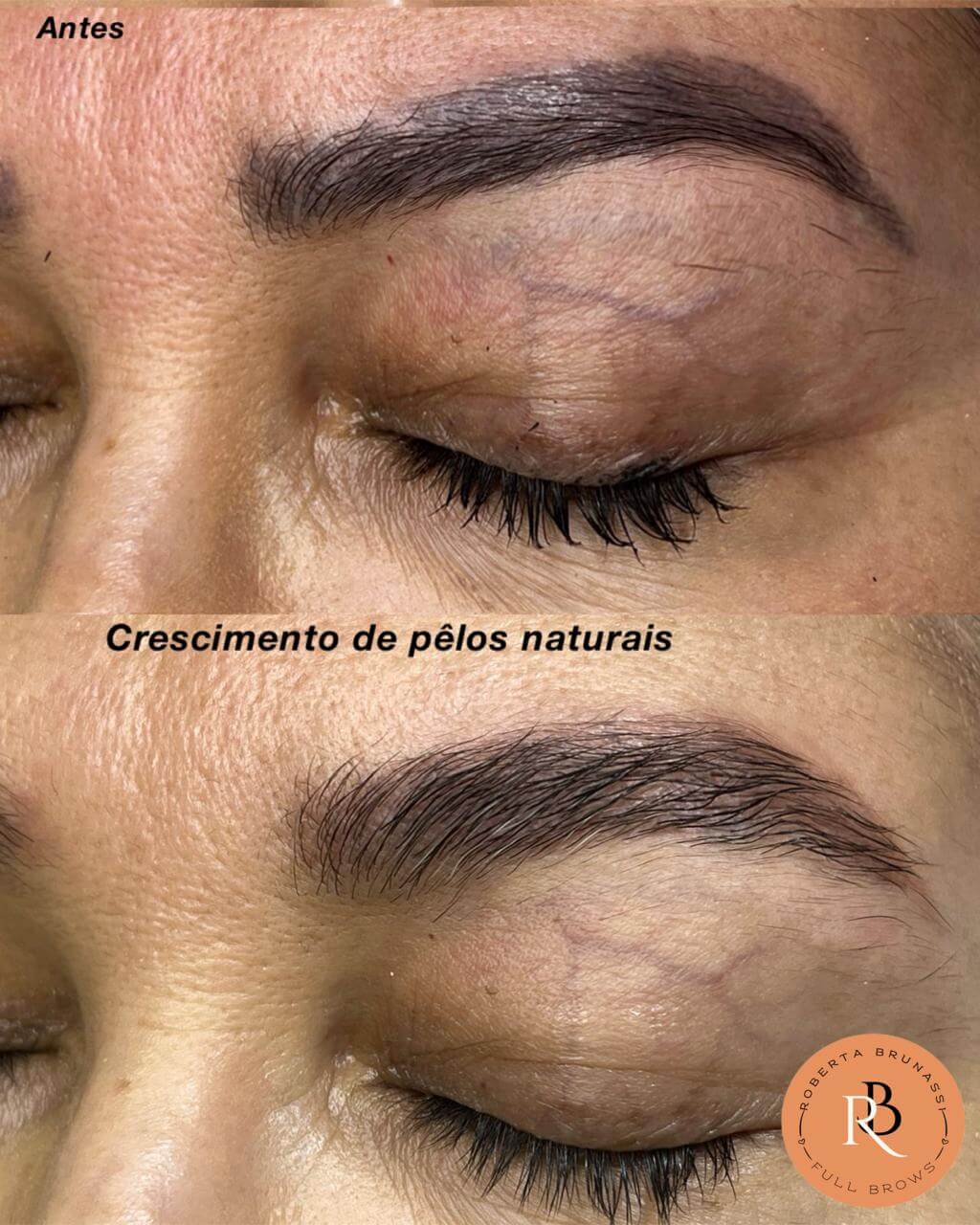 Resultado 3